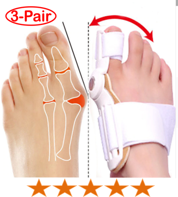 Orthopedic Bunion Corrector - A Non-Surgical Treatment - Image 12