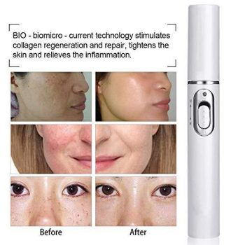 Advanced Skin Spots Removal Pen for Acne Scars and Wrinkless - Image 6