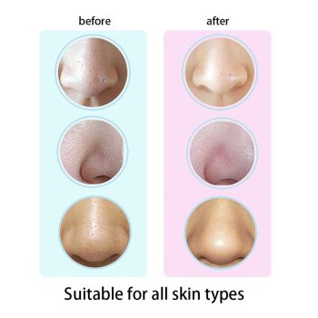 Blackhead Pore Vacuum - Image 7