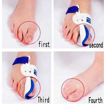 Bunion Corrector - Image 8