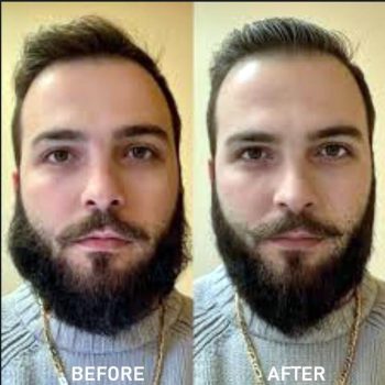 Professional Beard Straightener - Image 5