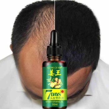 Ginger Essence Hairdressing Hair Essential Oil - Image 5
