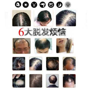 Ginger Essence Hairdressing Hair Essential Oil - Image 6