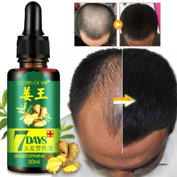 Ginger Essence Hairdressing Hair Essential Oil - Image 3