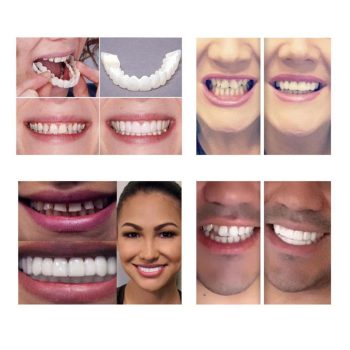 Premium Clip On Veneers - Image 4